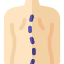 scoliosis